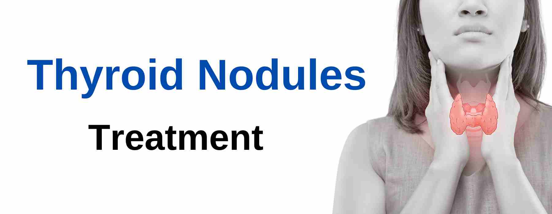 thyroid nodule treatment
